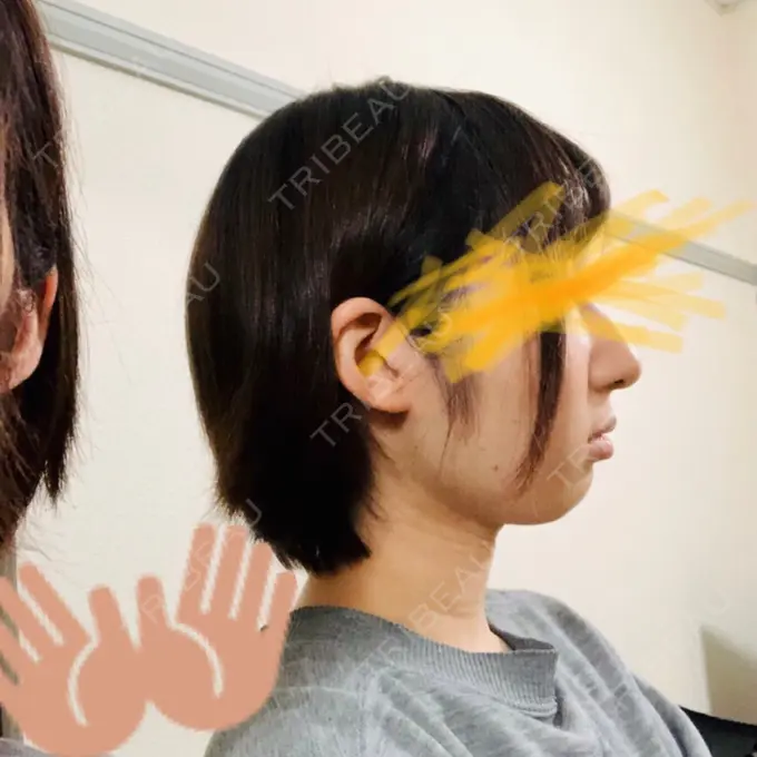 セットバック カトレア歯科・美容クリニック AFTER メイン用