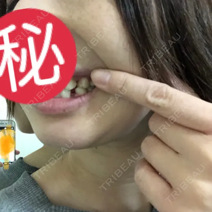 セットバック カトレア歯科・美容クリニック DAY 182 メイン用