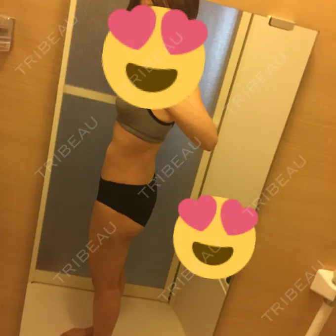 脂肪吸引（脚） / 脂肪吸引（お尻） ヨンセスリムライン DAY 69 メイン用