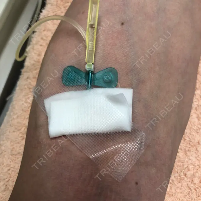 美容点滴・美容注射（美肌） 秋葉原スキンクリニック AFTER メイン用