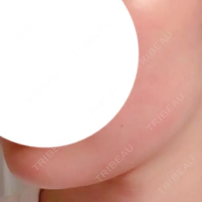 ボトックス（エラ・小顔） 湘南美容クリニック 仙台院 DAY 8 メイン用