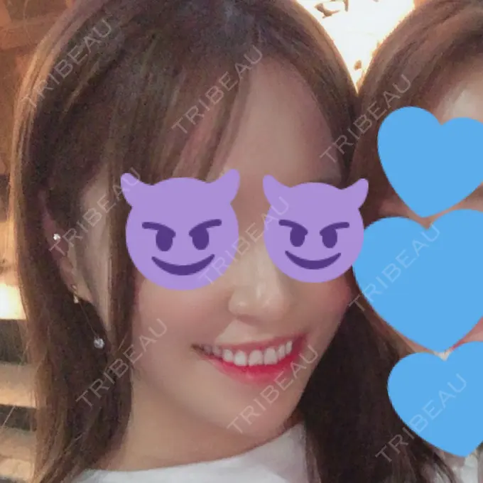 骨切り（あご） / 骨削り（エラ） / 輪郭修正 / その他（輪郭） RG整形外科（旧リオン整形外科） DAY 175 メイン用