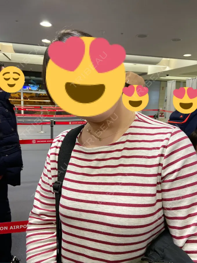 その他（目元） THE CLINIC（ザ・クリニック） 福岡院 DAY 177 メイン用