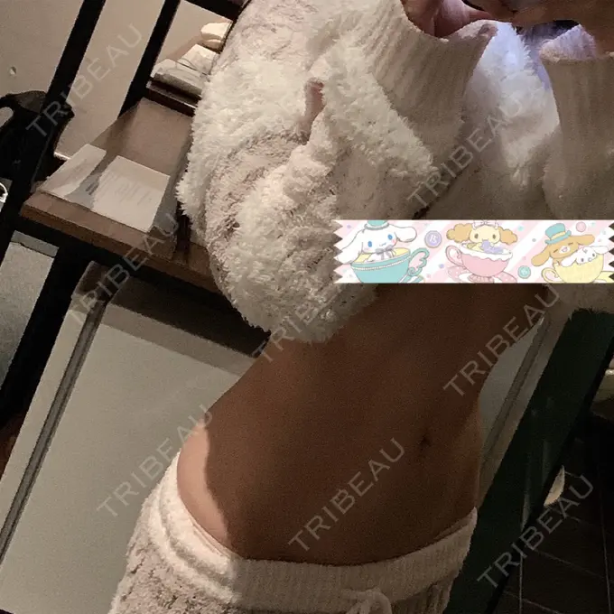 骨切り（あご） / 骨削り（エラ） / ルフォー+ssro（両あご) id（アイディ）美容外科 DAY 5 メイン用