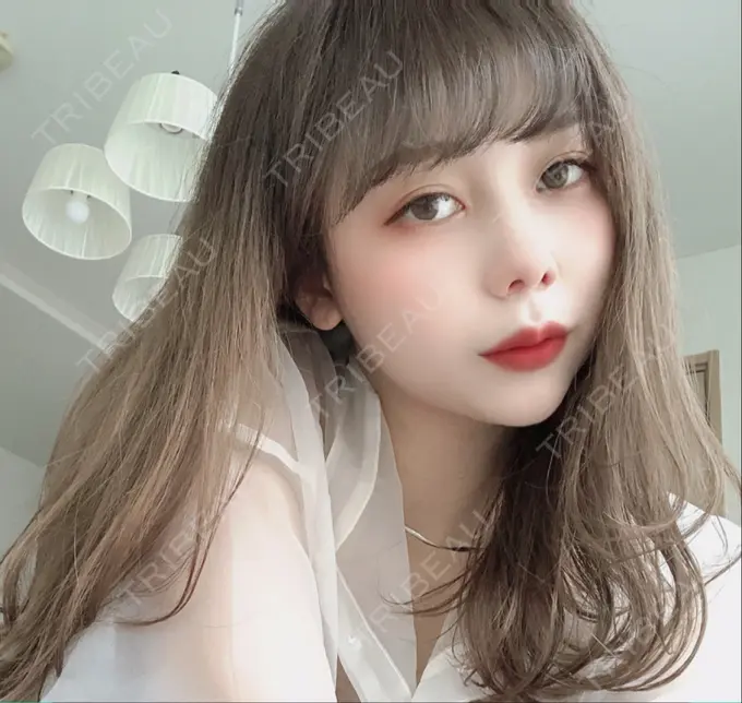 二重埋没 / 目頭切開 ドクター松井クリニック 新宿 DAY 31 メイン用