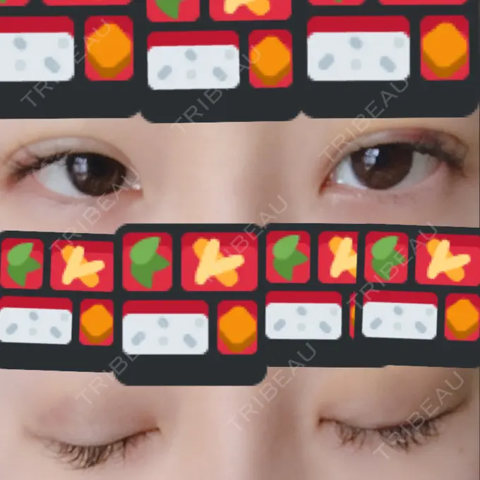 二重埋没 湘南美容クリニック 東京蒲田院 DAY 5 メイン用