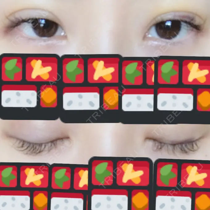 二重埋没 湘南美容クリニック 東京蒲田院 DAY 6 メイン用