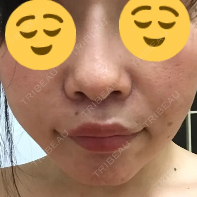 人中短縮 湘南メディカル記念病院（両国） DAY 8 メイン用