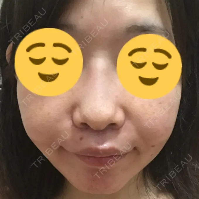 人中短縮 湘南メディカル記念病院（両国） DAY 10 メイン用