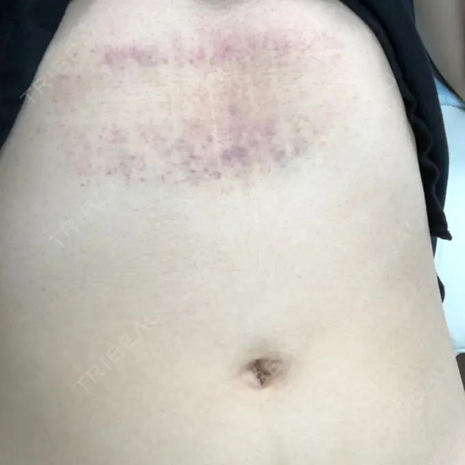 その他（ボディ） 船橋中央クリニック DAY 1 メイン用