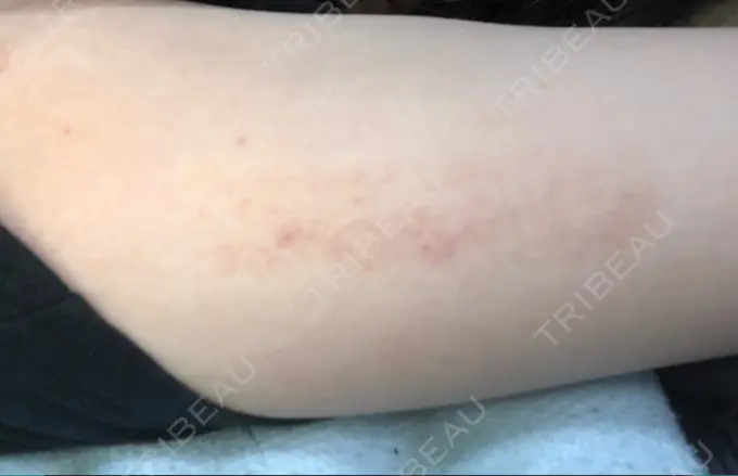 その他（ボディ） 船橋中央クリニック DAY 1 メイン用