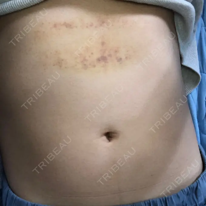 その他（ボディ） 船橋中央クリニック DAY 2 メイン用