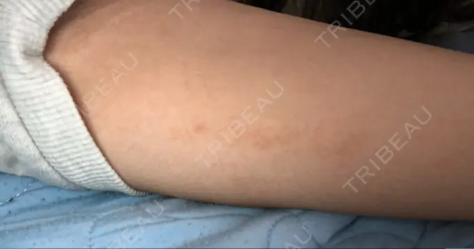 その他（ボディ） 船橋中央クリニック DAY 2 メイン用