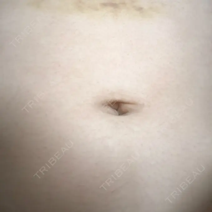 その他（ボディ） 船橋中央クリニック DAY 3 メイン用