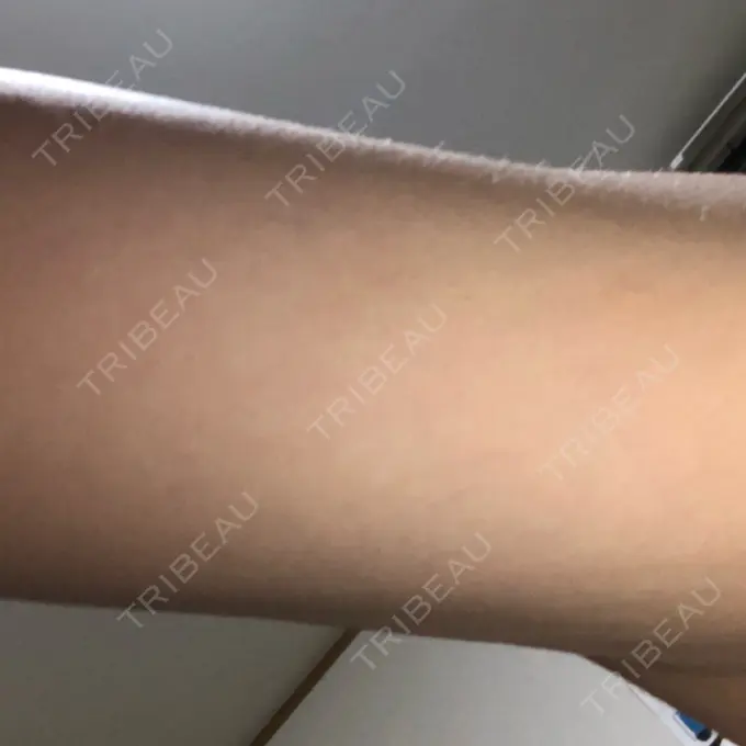 その他（ボディ） 船橋中央クリニック DAY 3 メイン用