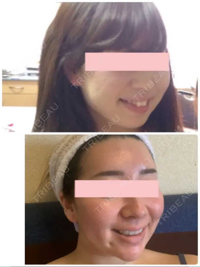 矯正（ワイヤー） 小倉IOI矯正歯科クリニック DAY 517 メイン用