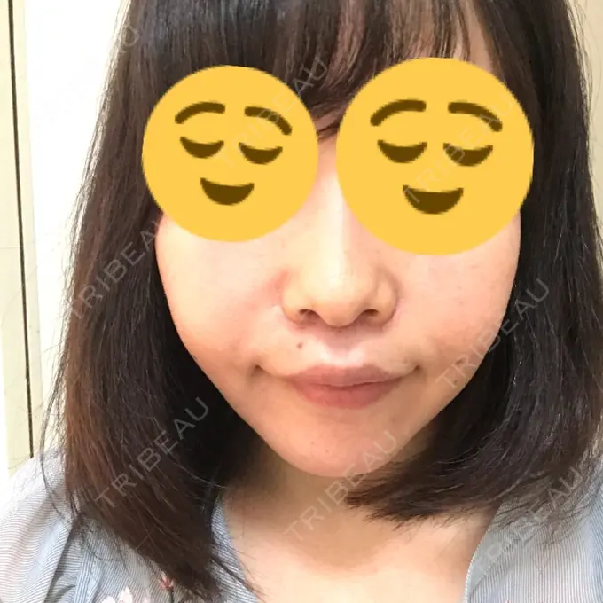 人中短縮 湘南メディカル記念病院（両国） DAY 14 メイン用