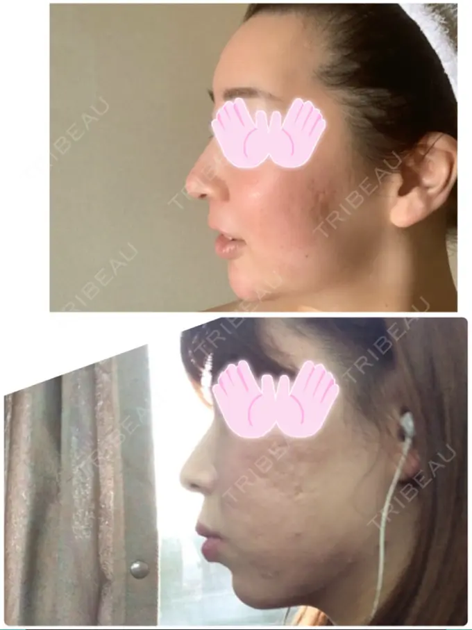 矯正（ワイヤー） 小倉IOI矯正歯科クリニック AFTER メイン用