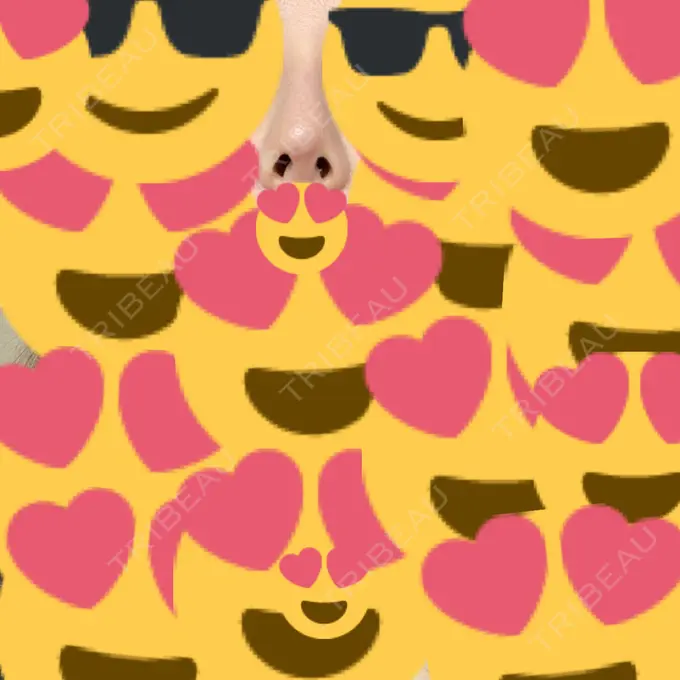 隆鼻術 / プロテーゼ除去 / 鼻修正 十仁美容整形 DAY 15 メイン用