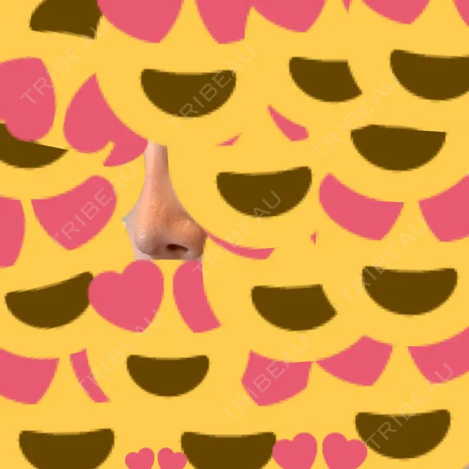 隆鼻術 / プロテーゼ除去 / 鼻修正 十仁美容整形 DAY 13 メイン用