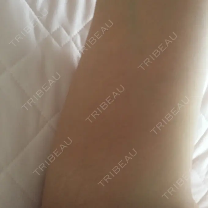 脂肪溶解注射（太もも） 湘南美容クリニック 仙台院 DAY 26 メイン用