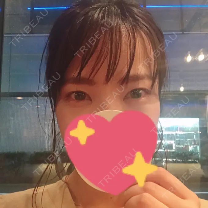 脂肪溶解注射（まぶた） / PRP皮膚再生療法 プルージュ美容クリニック 赤羽院 DAY 6 メイン用