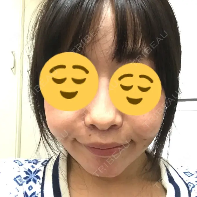 人中短縮 湘南メディカル記念病院（両国） DAY 34 メイン用