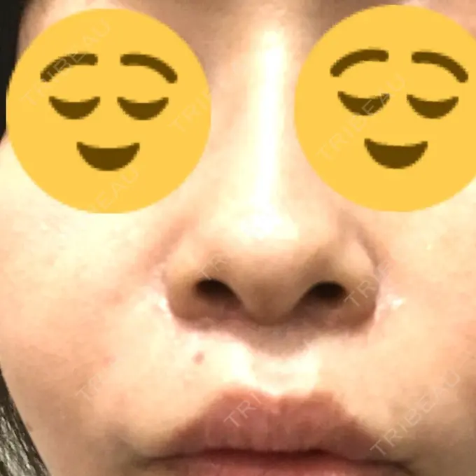 人中短縮 湘南メディカル記念病院（両国） DAY 34 メイン用