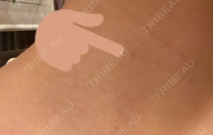 ほくろ・いぼ切除（肌） 医療法人美彩会 グランクリニック DAY 30 メイン用