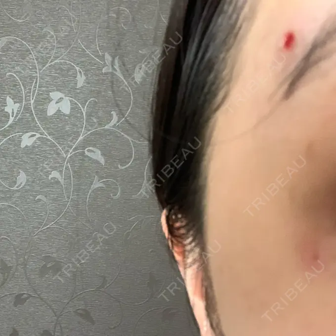 ほくろ・いぼ切除（肌） 医療法人美彩会 グランクリニック DAY 0 メイン用