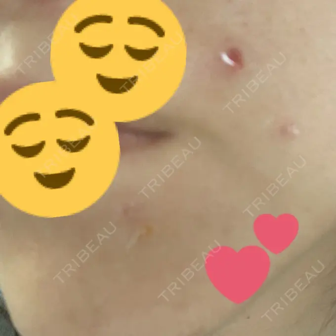 ほくろ・いぼ切除（肌） 医療法人美彩会 グランクリニック DAY 3 メイン用