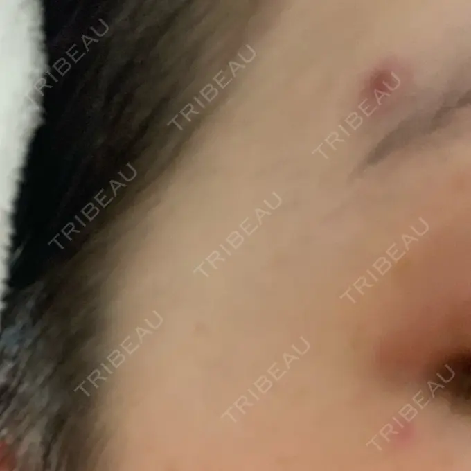 ほくろ・いぼ切除（肌） 医療法人美彩会 グランクリニック DAY 4 メイン用