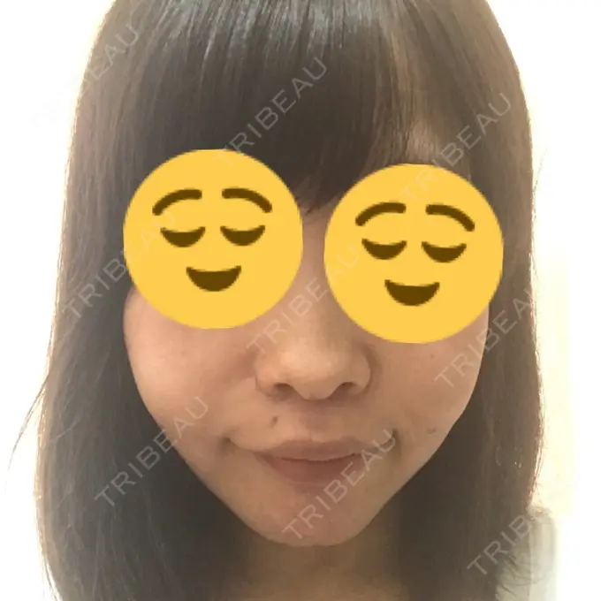 人中短縮 湘南メディカル記念病院（両国） DAY 43 メイン用