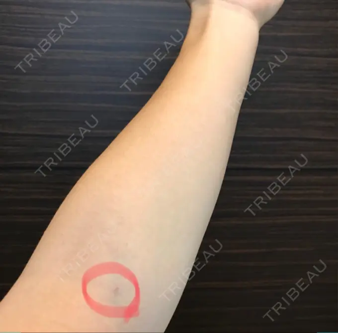 美容点滴・美容注射（美肌） 東京美容外科 梅田院 DAY 0 メイン用