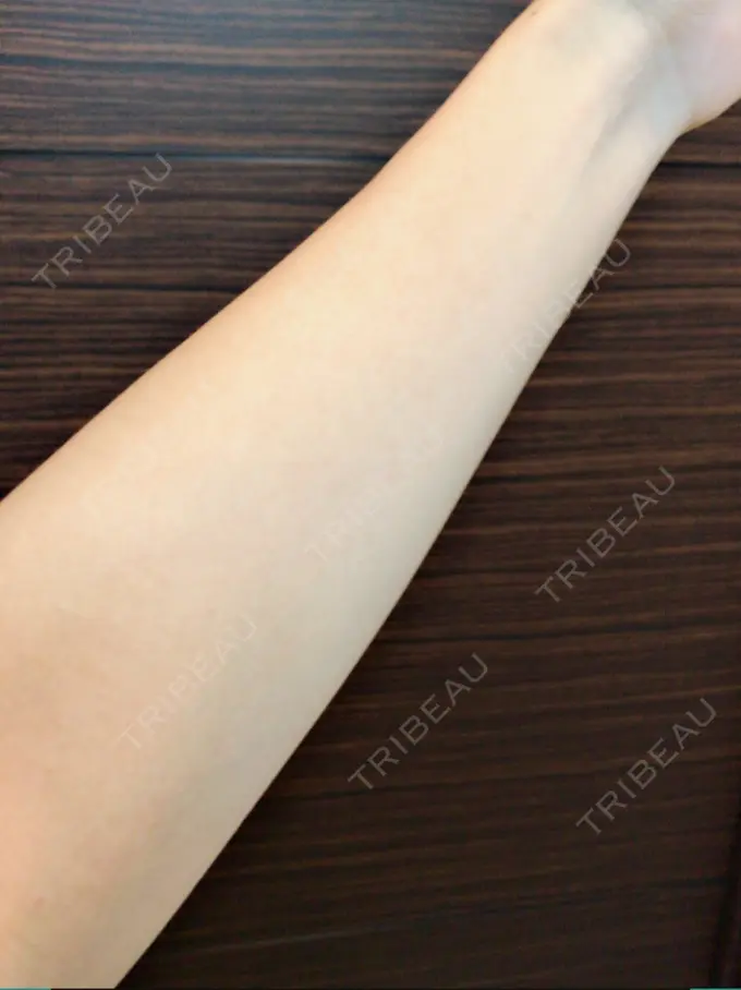 美容点滴・美容注射（美肌） 東京美容外科 梅田院 AFTER メイン用