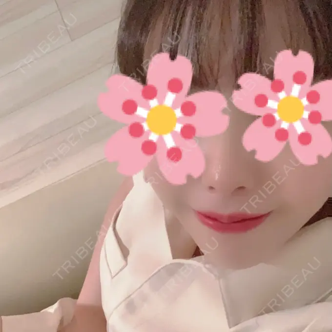 人中短縮 / PRP皮膚再生療法 BIANCA銀座 DAY 98 メイン用