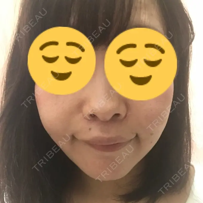 人中短縮 湘南メディカル記念病院（両国） DAY 51 メイン用