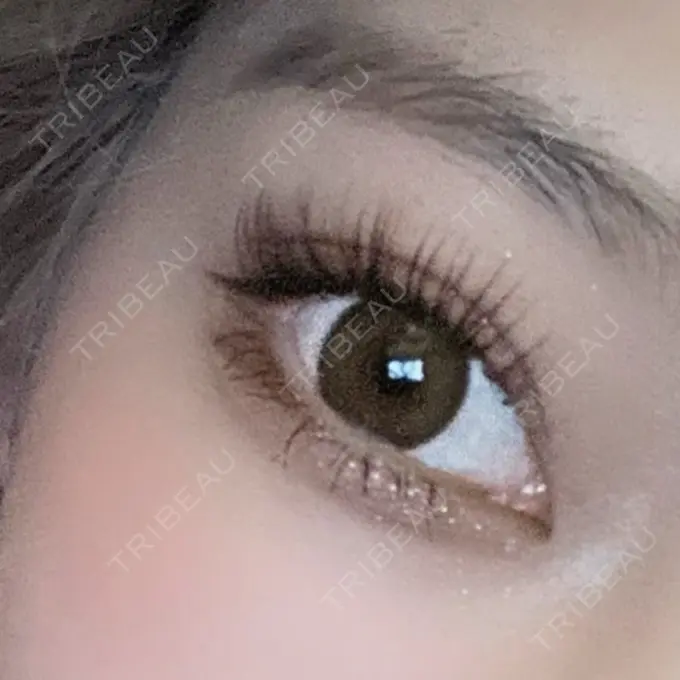 二重埋没 R Beauty CLINIC 銀座院 AFTER メイン用