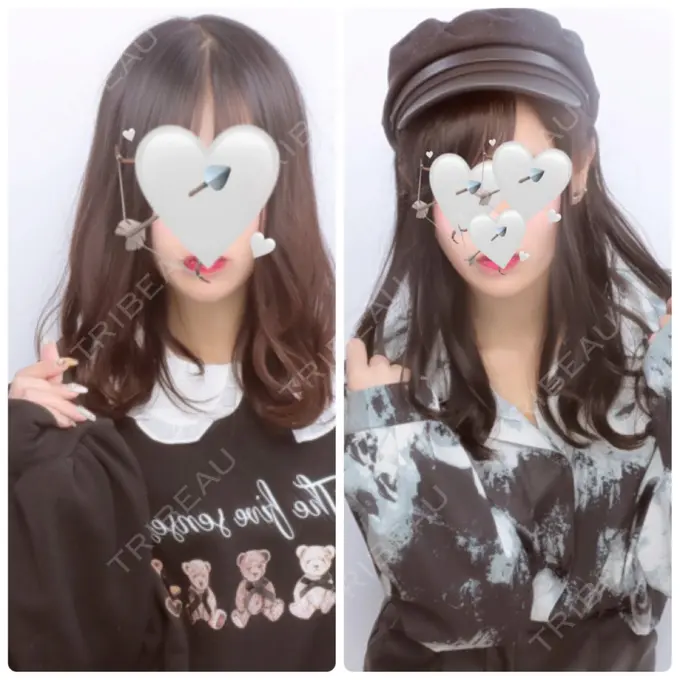 脂肪吸引（顔） ガーデンクリニック 名古屋院 AFTER メイン用