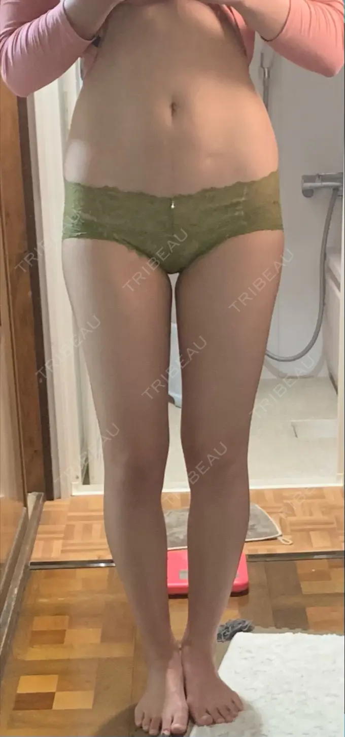 GLP-1ダイエット プライベートクリニック 高田馬場 AFTER メイン用