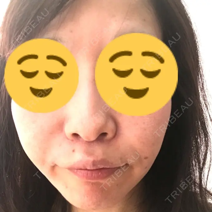 人中短縮 湘南メディカル記念病院（両国） AFTER メイン用