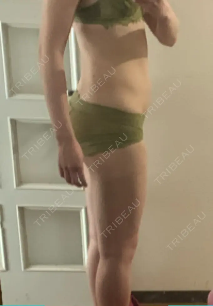 GLP-1ダイエット おおしま皮膚科 DAY 10 メイン用