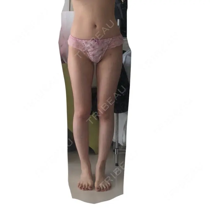 脂肪吸引（脚） / 豊胸（脂肪注入） 神戸中央クリニック美容外科 AFTER メイン用