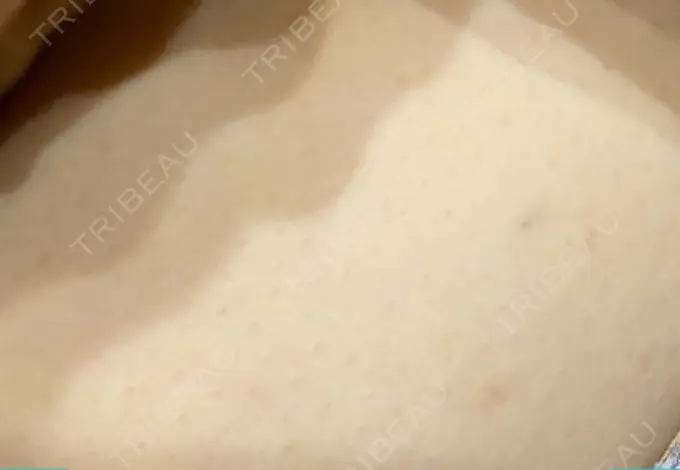 GLP-1ダイエット 湘南美容クリニック 横須賀中央院 DAY 6 メイン用