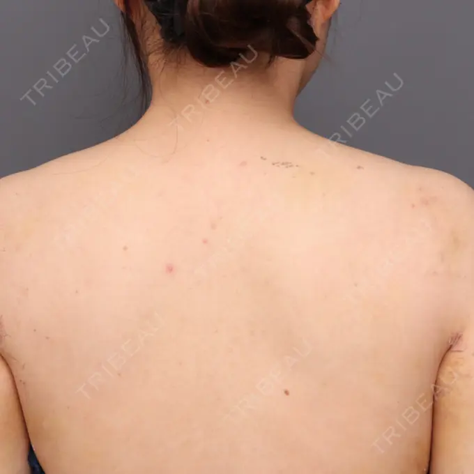 その他（ボディ） THE CLINIC（ザ・クリニック） 福岡院 DAY 2 メイン用