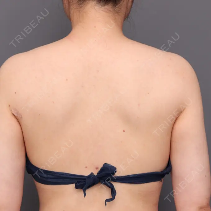 その他（ボディ） THE CLINIC（ザ・クリニック） 福岡院 AFTER メイン用