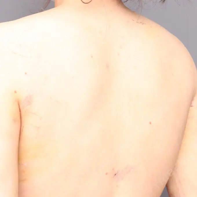 その他（ボディ） THE CLINIC（ザ・クリニック） 福岡院 DAY 7 メイン用