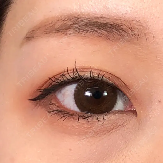 二重埋没 MIL CLINIC OSAKA AFTER メイン用