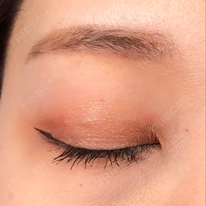 二重埋没 MIL CLINIC OSAKA DAY 43 メイン用