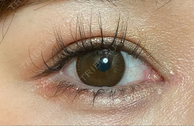 二重埋没 / ヒアルロン酸注入（涙袋） / ヒアルロン酸注入（目の下） 湘南美容クリニック 千葉センシティ院 AFTER メイン用